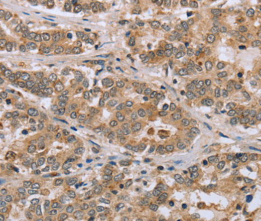 CLEC16A Polyclonal Antibody – Figure 1 of 2