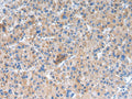 GLRA1 Polyclonal Antibody – Figure 1 of 3