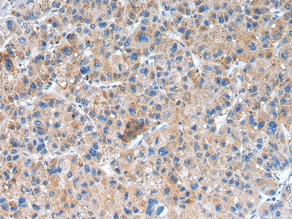 GLRA1 Polyclonal Antibody – Figure 1 of 3