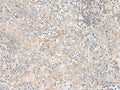 FGF13 Polyclonal Antibody – Figure 1 of 3