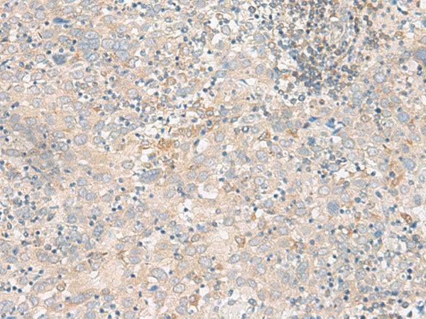 FGF13 Polyclonal Antibody – Figure 1 of 3