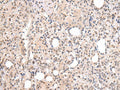 CBX7 Polyclonal Antibody – Figure 1 of 3