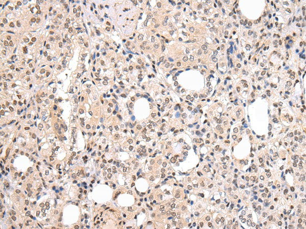 CBX7 Polyclonal Antibody – Figure 1 of 3