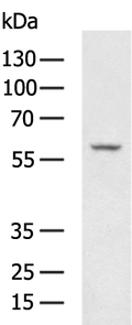 PLAT Polyclonal Antibody – Figure 1 of 4