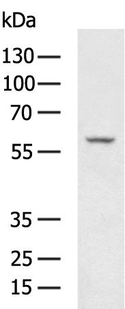 PLAT Polyclonal Antibody – Figure 1 of 4