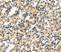 CK-17 Polyclonal Antibody – Figure 1 of 3