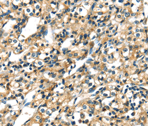 CK-17 Polyclonal Antibody – Figure 1 of 3