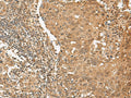 TIPRL Polyclonal Antibody – Figure 1 of 3