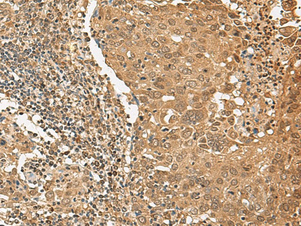 TIPRL Polyclonal Antibody – Figure 1 of 3