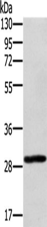 EDA2R Polyclonal Antibody – Figure 1 of 4