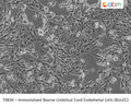 Immortalized Bovine Umbilical Cord Endothelial Cells (BUcEC) | Applied Biological Materials (abm)