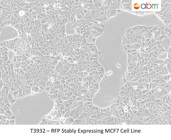 RFP Stably Expressing MCF7 Cell Line | Applied Biological Materials (abm)