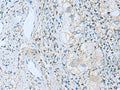 EMILIN1 Polyclonal Antibody – Figure 1 of 3
