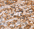 CD80 Polyclonal Antibody – Figure 1 of 3