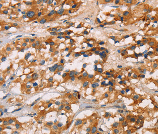 CD80 Polyclonal Antibody – Figure 1 of 3