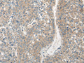 CLIC6 Polyclonal Antibody – Figure 1 of 2
