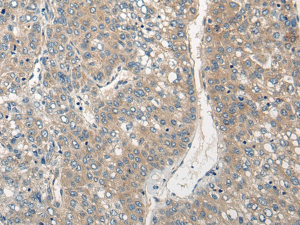 CLIC6 Polyclonal Antibody – Figure 1 of 2