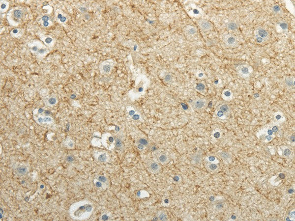 WNT2 Polyclonal Antibody – Figure 1 of 3
