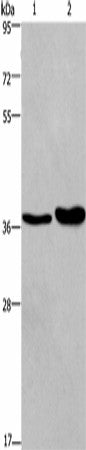 FUT1 Polyclonal Antibody – Figure 1 of 4
