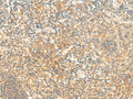 CD93 Polyclonal Antibody – Figure 1 of 2