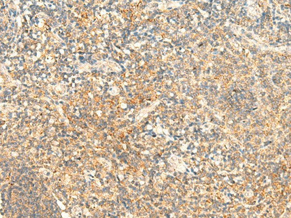 CD93 Polyclonal Antibody – Figure 1 of 2