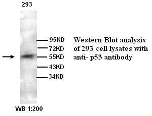 Anti-p53 Antibody – Figure 1 of 1