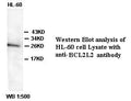 Anti-BCL2L2 Antibody – Figure 1 of 1