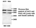 Anti-Smad2 Antibody – Figure 1 of 1