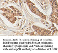 Anti-hsp70 Antibody – Figure 1 of 1
