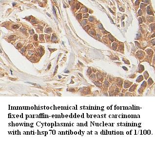 Anti-hsp70 Antibody – Figure 1 of 1