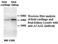 Anti-ACAA1 Antibody – Figure 1 of 1
