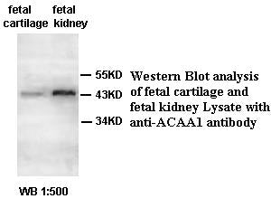 Anti-ACAA1 Antibody – Figure 1 of 1