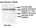 Anti-AGPS Antibody – Figure 1 of 1