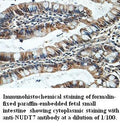 Anti-NUDT7 Antibody – Figure 1 of 1