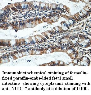 Anti-NUDT7 Antibody – Figure 1 of 1