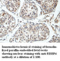 Anti-RBBP6 Antibody – Figure 1 of 1