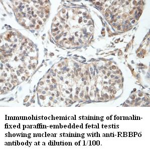Anti-RBBP6 Antibody – Figure 1 of 1