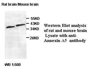 Anti-Annexin A5 Antibody – Figure 1 of 1