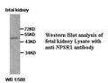 Anti-NPSR1 Antibody – Figure 1 of 1