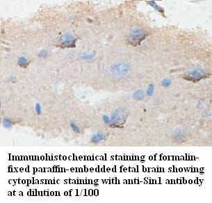 Anti-Sin1 Antibody – Figure 1 of 1