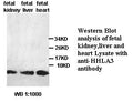 Anti-HHLA3 Antibody – Figure 1 of 1