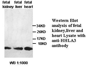 Anti-HHLA3 Antibody – Figure 1 of 1