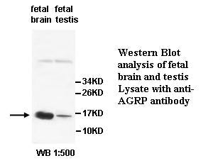 Anti-AGRP Antibody – Figure 1 of 1