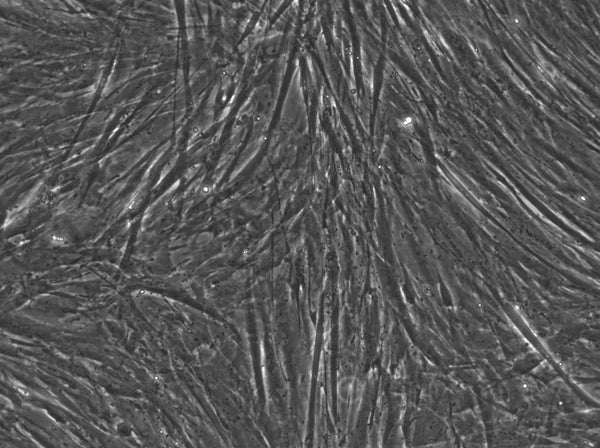 HK/FDC cell