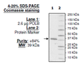 DNA Polymerase β (POLB), His-tag Recombinant – Figure 1 of 1
