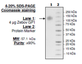 Zebov GP1, His-tag Recombinant – Figure 1 of 1