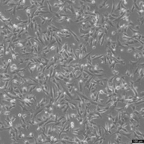2106T cell