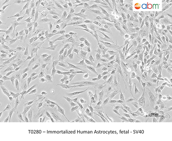 Immortalized Human Astrocytes, fetal - SV40 – Figure 1 of 1