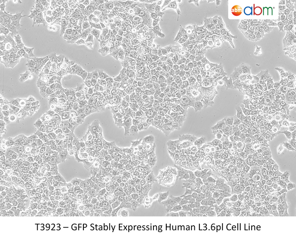 GFP Stably Expressing Human L3.6pl Cell Line | Applied Biological Materials (abm)