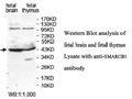 Anti-SMARCB1 Antibody – Figure 1 of 1